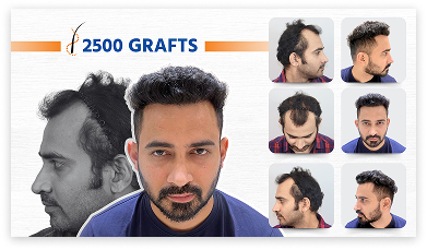 Patient before and after 1